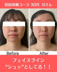 初回体験価格!モニタープラン① トライアングルフェイシャル®️