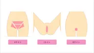 VIO脱毛 1回分(カウンセリング込み)🧖♀️