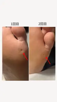 👣足裏のお悩み徹底ケア♪フットケア60分。膝下オイルマッサージ付き