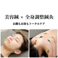 【期間限定キャンペーン】人気No.1！贅沢全身鍼灸（90分）