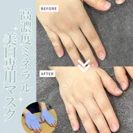🩵ご協力価格🩵 【美白集中コース】ピーリング+ミネラル美白パック