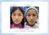 🌸7月31日限定🌸すっぴん褒められ肌🤍大人気肌管理メニュー✨水光ピーリング効果を実感❤続けるほど水光肌が育つ❣