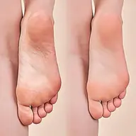 フット角質ケア✨トリートメント付き