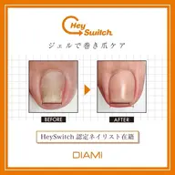 巻き爪ケア〔親指2本〕