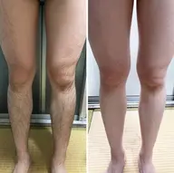 メンズ【脚まるごと】短パンはいてもキレイ！