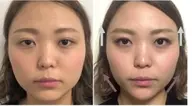 【クイック】10分で顔が変わる!筋膜剥がし★痛いですが我慢して突っつけばスッキリ♡自宅でのやり方教えます!レベル1〜