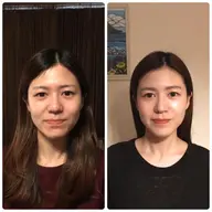 🌟ミニモ限定🌟小顔矯正3回セット【小顔美容矯正・首肩頭マッサージ】パック付💕