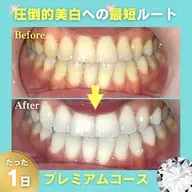 《人気No.1◎圧倒的美白》プレミアムホワイト 10分×3回 ¥14,940 → ¥6,000