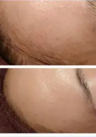 顔