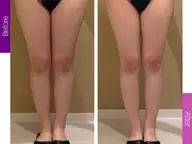 【口コミ+掲載写真必須】冷え/むくみ★ハイパーナイフEX下半身スタイルアップ60分¥16500
