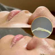 【産毛•角栓スッキリ】美肌フェイスwax艶肌パック付