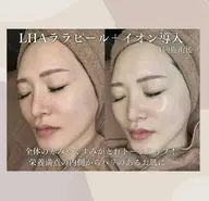 《ロコミご協力限定‼️》特別価格✨️｜韓国で大人気【ララピール】 ⚠️注意事項確認必須
