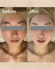 【初回限定】白玉小顔矯正🤍美肌ケア付きの小顔ケア💆🏼‍♀️