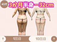(初回限定) 部分集中引き締め痩身(太もも、ヒップ)