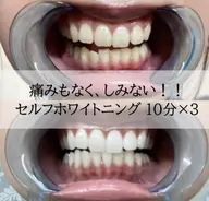 💝初回体験💝セルフホワイトニング10分×3回〜安心のカウンセリング付き〜