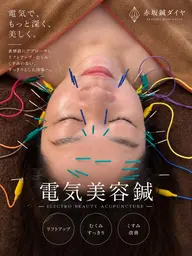 【当サロン人気No.1】✨美容鍼プレミアム✨90分　　　　　　美容鍼＋ダーマ鍼＋パック