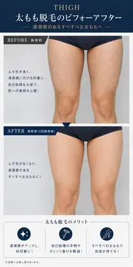 🔷メンズ 足(膝〜太もも)