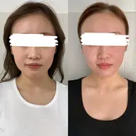 ✨ミニモ学割✨【小顔矯正+骨盤矯正+頭蓋骨矯正】骨格美容矯正❗肩幅矯正/ボディケア/左右差/巻き肩/二の腕/男性スタッフ