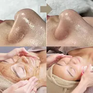 開き・たるみ毛穴コース
