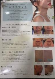 レミラ 美顔フォト 初回