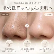 【本気で美肌を目指す方へ$】水光肌実感◎韓国美肌に0°毛穴すっきり洗浄体験 〈90分〉¥0