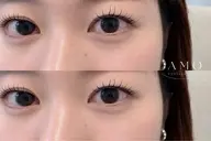 【特別価格】💕 シングルフラットラッシュ100本 オフ➕アイシャンプー込