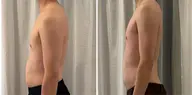 上半身痩身コルギ（カッピング、ホットストーン付き）