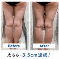 キャビテーション40分+下半身or上半身痩身エステ50分