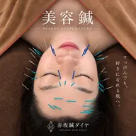 【初めての美容鍼に】🌼美容鍼お試し体験🌼 ¥5,500