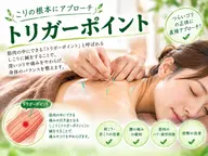 トリガーポイントはり