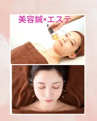 【先着3名様】✨美容鍼×エステモニター 100分✨ビフォーアフター写真掲載にご協力いただける方)✨