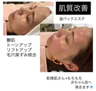 温パックエステ（Waxエステ）