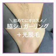 初めてにオススメ✨両脇シュガーリング+光脱毛🍋