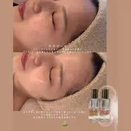 【温活×ツヤ肌】黄土よもぎ蒸し+韓国肌管理