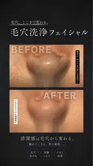 男性人気𝐍𝐨. 𝟏 【毛穴洗浄フェイシャル】