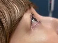 ラッシュリフト