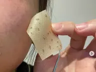 ③シミとお別れの日/剥がすシミ取りで爽快/100%フルーツ酸使用で安心/1回で◯/まずはお試し1×1cmサイズまで