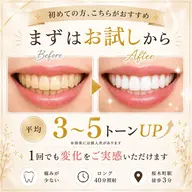 『美歯活でキレイな歯を目指そう✨』黄ばみを放置してませんか?まずはお試しから♪横浜市内最長☆40分照射 ¥3,300
