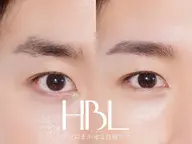 【6月限定価格】大人気HBLがお得に🉐✨期間限定、モデル価格での施術が可能です♪メンズ限定🙆♂️