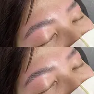 美眉ワックス脱毛