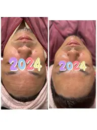 【メンズフェイシャル】 メンズもお肌きれいにしませんか?メンズ専用のフェイシャルエステ60分