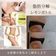 🎊28th 感謝キャンペーン限定価🎉 🍋韓国美容【お腹/脚/二の腕】1箇所選べる♪キャビ&RF✖️リンパマッサージ