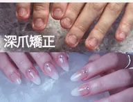 【自爪育成/深爪矯正コース】長さだし+ジェルコーティング🌟専門の知識と技術で、自爪を造形し、見違える指先に🌟💅