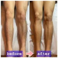 【✨️脚全体脱毛✨️】メンズ限定‼️太もも裏表/すね、ふくらはぎ/足の指甲/すべて含みます。3回まで同価格❕都度払い✨️