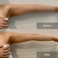 【二の腕/肩周り】WINBACK華奢見え集中ケア🌿60分　¥16,000→