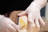 全顔　WAX脱毛