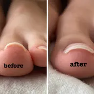 【FOOT】（オフあり）親指巻き爪ケア+ジェルワンカラー