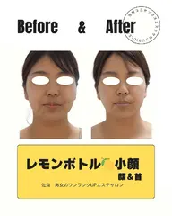 【今注目の小顔】レ モンボト ル小顔お試し