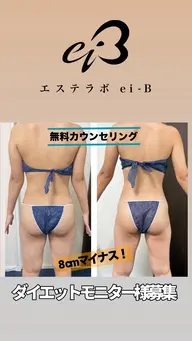 女性専用　ダイエットエステ体験