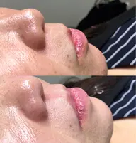 【肌が綺麗になる】フェイスワックス